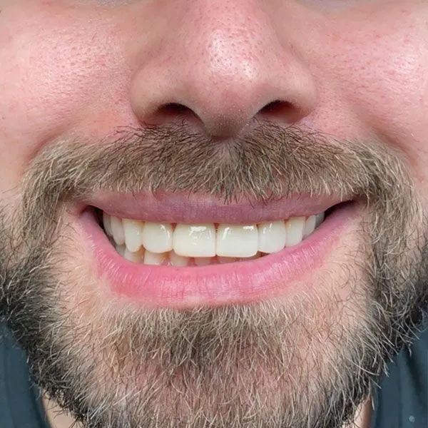 Farmington Dental Studio before and after result