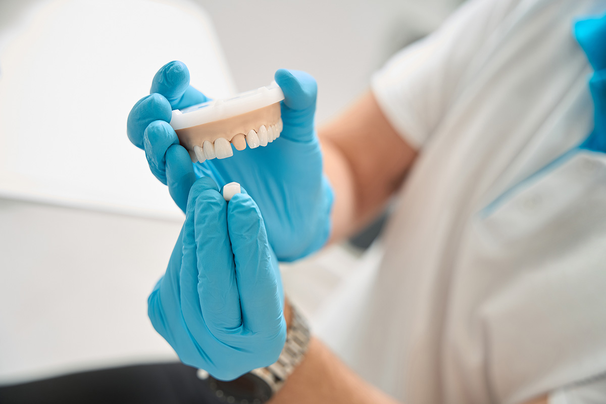 Farmington Hills Dentist | Dental Crowns