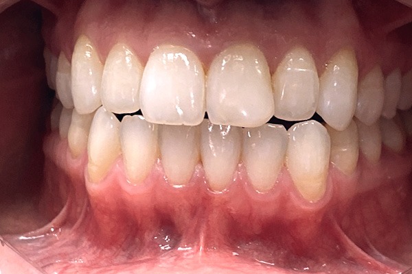 Before dental treatment photo
